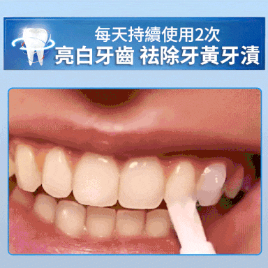 祛黃祛漬美牙筆